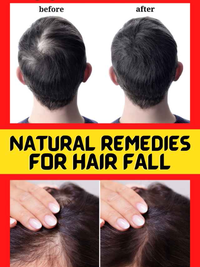 Top 5 Hair fall Control Remedies That Actually Work